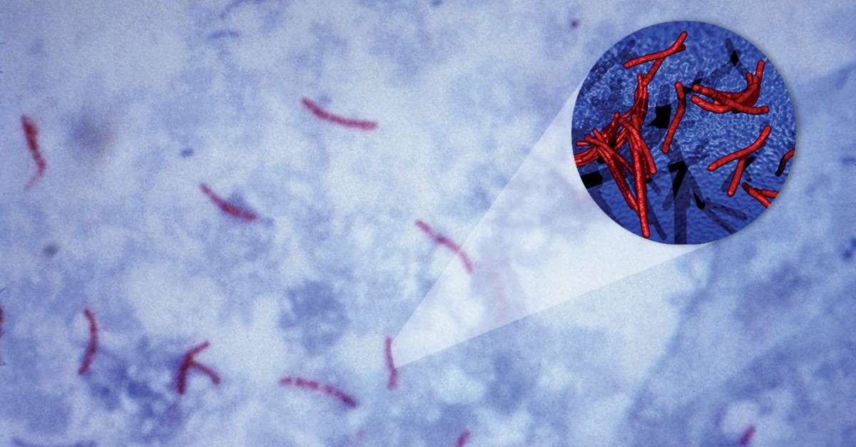 Палочки в мокроте. Mycobacterium tuberculosis окраска по Цилю-Нильсену. Микроскопия по Цилю Нильсену туберкулез. Микобактерии Циль Нильсен. Микобактерии туберкулеза микроскопия.